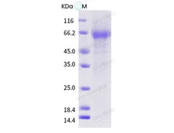 Sino Biological Influenza A H1N1 (A/Sw/Bulnes/VN1401-P6SP/2018) Neuraminidase