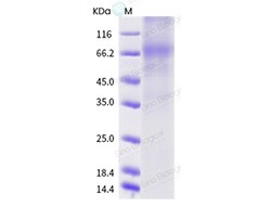 Sino Biological Influenza A H1N1 (A/swine/Alberta/SD0154/2016) Neuraminidase