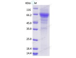 Sino Biological Influenza A H1N1 (A/swine/Canada/01093/2006) Neuraminidase