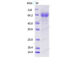 Sino Biological Influenza A H1N1 (A/Auckland/606/2001) Neuraminidase /