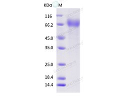 Sino Biological Influenza A H1N1 (A/Auckland/6/1996) Neuraminidase / NA