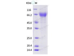 Sino Biological Influenza A H1N1 (A/swine/Denmark/19216B/1993) Neuraminidase
