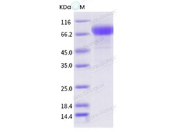 Sino Biological Influenza A H1N1 (A/AA/Marton/1943) Neuraminidase / NA