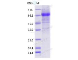 Sino Biological Influenza A H1N1 (A/Henry/1936) Neuraminidase / NA (His