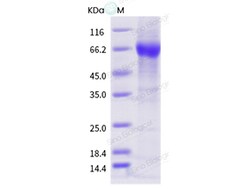 Sino Biological Influenza A H1N1 (A/swine/Iowa/15/1930) Neuraminidase /