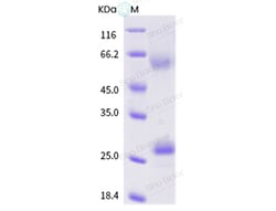 Sino Biological Influenza A H5N1 (A/chicken/VietNam/NCVD-016/2008) Hemagglutinin