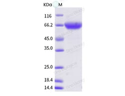 Sino Biological Influenza A H1N1 (A/WSN/1933) Hemagglutinin / HA Protein
