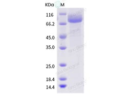 Sino Biological Influenza B (B/Hong Kong/CUHK50947/2004) Hemagglutinin