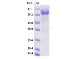 Sino Biological Influenza B (B/Sydney/3/2002) Hemagglutinin / HA Protein