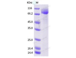 Sino Biological Influenza B (B/Ann Arbor/1/1986) Hemagglutinin / HA Protein