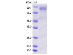 Sino Biological Influenza B (B/Maryland/1959) Hemagglutinin / HA Protein
