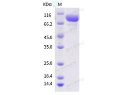 Sino Biological Influenza A H3N2 (A/Mexico/InDRE2250/2005) Hemagglutinin