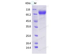 Sino Biological Influenza A H1N2 (A/swine/North Carolina/01169/2006) Hemagglutinin