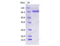 Sino Biological Influenza A H1N1 (A/swine/Saskatchewan/SD0056/2014) Hemagglutinin