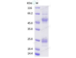 Sino Biological Influenza A H5N1 (A/Cambodia/X0123311/2013) Hemagglutinin