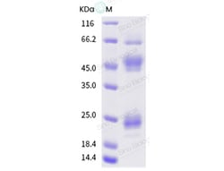 Sino Biological Influenza A H5N1 (A/Bangladesh/207095/2008) Hemagglutinin