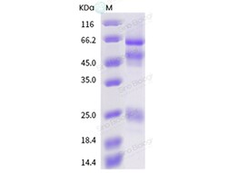 Sino Biological Influenza A H5N1 (A/China/2006) Hemagglutinin / HA Protein