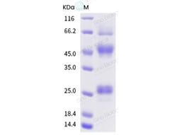 Sino Biological Influenza A H5N1 (A/Hong Kong/378.1/2001) Hemagglutinin