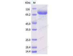 Sino Biological Influenza A H3N2 (A/swine/Mexico/AVX13/2012) Hemagglutinin