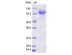 Sino Biological Influenza A H3N2 (A/swine/Colorado/A01203748/2012) Hemagglutinin