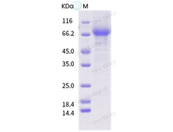 Sino Biological Influenza A H3N2 (A/swine/Denmark/101501-1/2010) Hemagglutinin