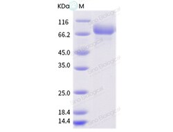 Sino Biological Influenza A H3N2 (A/swine/Spain/33601/2001) Hemagglutinin