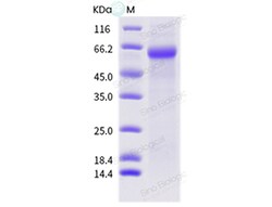 Sino Biological Influenza A H3N1 (A/swine/England/704563/1995) Hemagglutinin