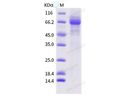 Sino Biological Influenza A H1N1 (A/swine/Mexico/AVX47/2013) Hemagglutinin
