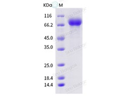 Sino Biological Influenza A H1N2 (A/swine/Belgium/Oostkamp-26/2012) Hemagglutinin