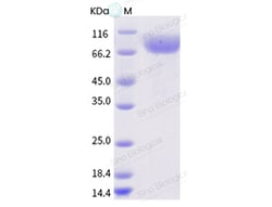 Sino Biological Influenza A H1N2 (A/Minnesota/14/2012) Hemagglutinin /