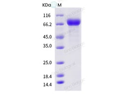 Sino Biological Influenza A H1N2 (A/swine/Hong Kong/4083/2011) Hemagglutinin