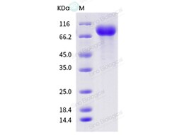 Sino Biological Influenza A H1N1 (A/swine/Canada/01093/2006) Hemagglutinin