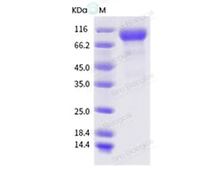 Sino Biological Influenza A H1N1 (A/swine/England/383/2005) Hemagglutinin