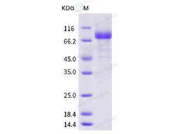 Sino Biological Influenza A H1N1 (A/Thailand/271/2005) Hemagglutinin /