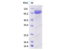 Sino Biological Influenza A H1N1 (A/Iowa/CEID23/2005) Hemagglutinin / HA