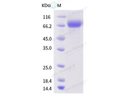 Sino Biological Influenza A H1N2 (A/swine/Kansas/00246/2004) Hemagglutinin