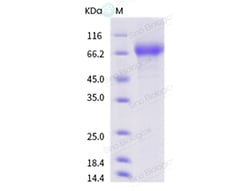 Sino Biological Influenza A H1N2 (A/swine/Saitama/21/2004) Hemagglutinin