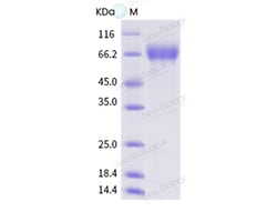 Sino Biological Influenza A H1N1 (A/swine/Eire/89/1996) Hemagglutinin /