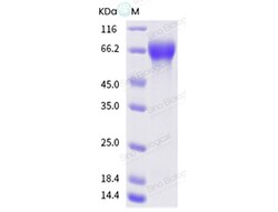 Sino Biological Influenza A H1N1 (A/swine/OMS/2112/1995) Hemagglutinin