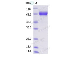 Sino Biological Influenza A H1N1 (A/NewJersey/8/1976) Hemagglutinin / HA