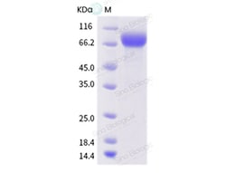 Sino Biological Influenza A H1N1 (A/AA/Huston/1945) Hemagglutinin / HA