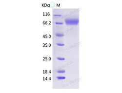 Sino Biological Influenza A H1N1 (A/swine/Cambridge/1939) Hemagglutinin