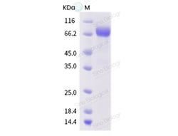 Sino Biological Influenza A H1N1 (A/swine/Ohio/23/1935) Hemagglutinin /