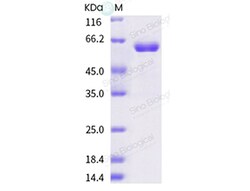 Sino Biological Influenza A H1N1 (A/swine/Shandong/1207/2016) Neuraminidase
