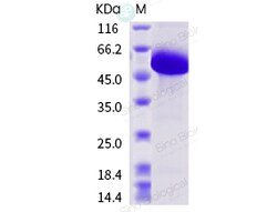 Sino Biological Influenza A H1N1 (A/swine/Shandong/1207/2016) Hemagglutinin