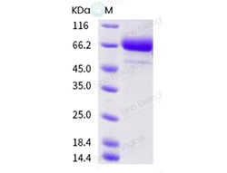 Sino Biological Influenza A H1N1 (A/swine/Jiangsu/J004/2018) Hemagglutinin