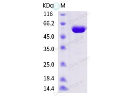 Sino Biological Influenza A H1N1 (A/swine/Jiangsu/J004/2018) Hemagglutinin