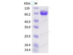 Sino Biological Influenza A H1N1 (A/swine/Henan/SN13/2018) Hemagglutinin