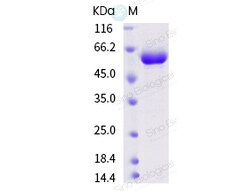 Sino Biological Influenza A H1N1 (A/swine/Hebei/0116/2017) Hemagglutinin