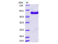 Sino Biological Human mastadenovirus B (HAdV-B) encapsidation protein IVa2